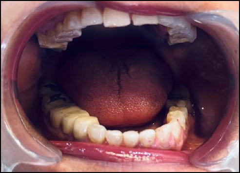 Nice teeth