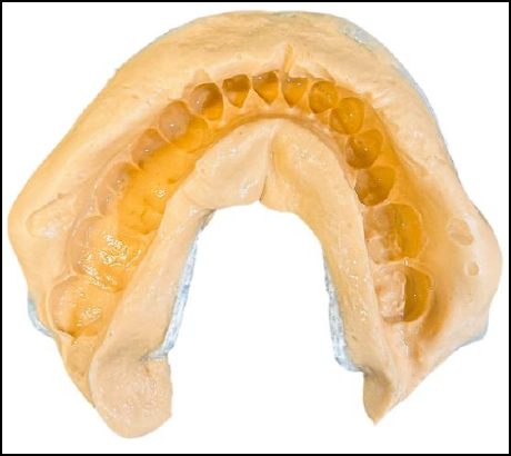 Yellow Teeth
